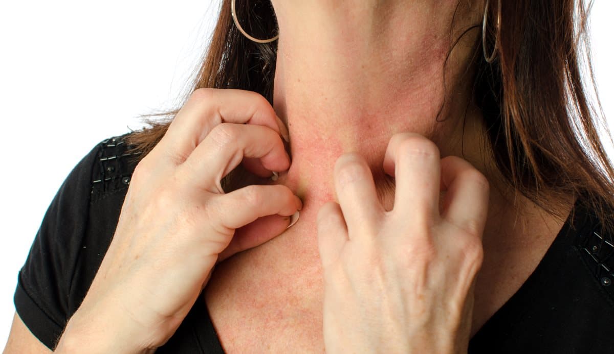 Contact Dermatitis vs. Eczema: How to Tell the Difference